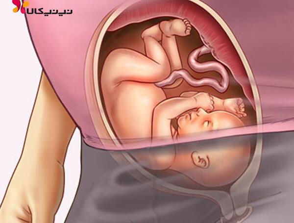 عکس جنین بیست و شش هفته
