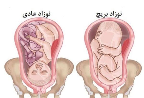 عکس هفته بیست و نهم بارداری