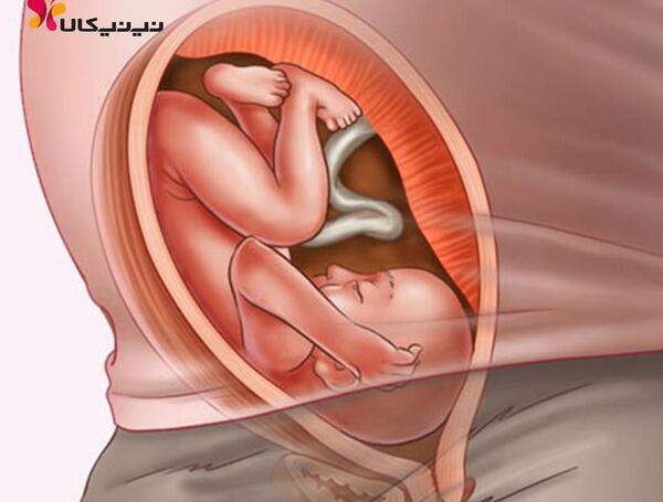 عکس هفته بیست و نهم بارداری