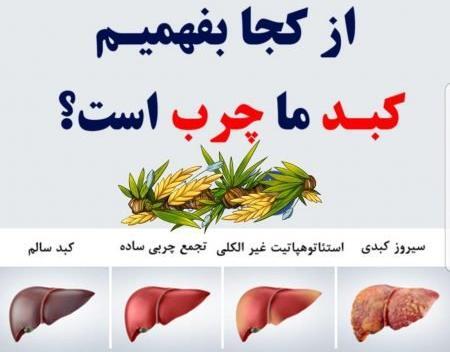 عکس کبد چرب
