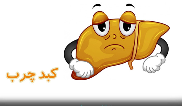 عکس کبد چرب