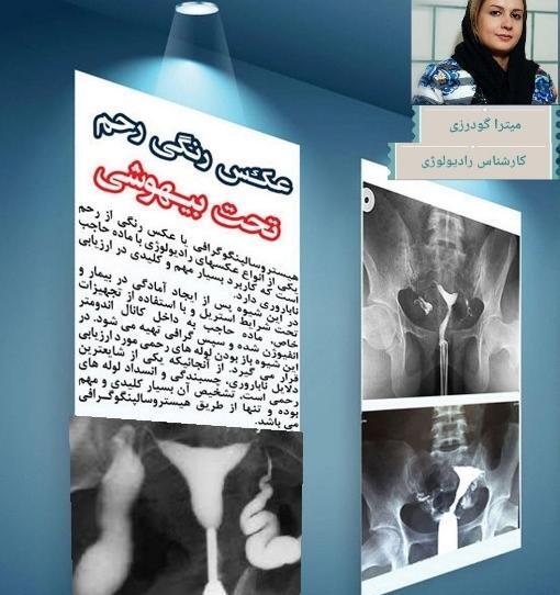 کیا عکس رنگی رحم گرفتن