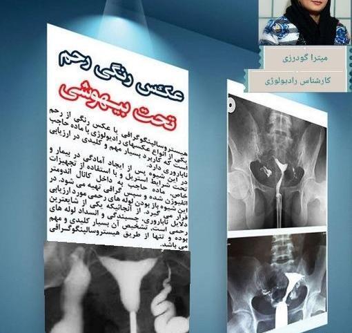 کیا عکس رنگی قلب گرفتن