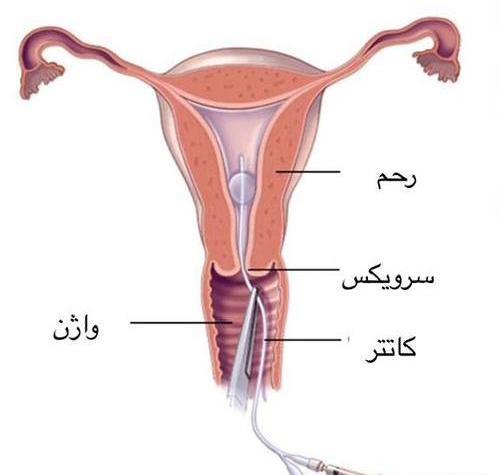 کیا عکس رنگی قلب گرفتن