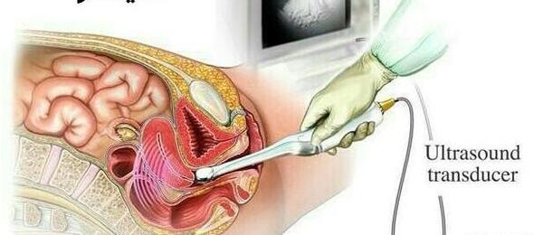کیا عکس رنگی قلب گرفتن