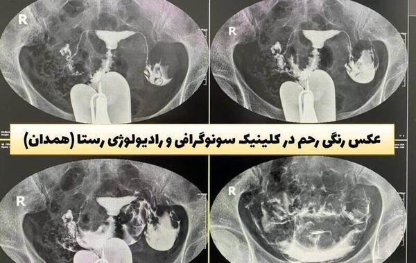 کیا عکس رنگی رحم گرفتن سال ۹۹