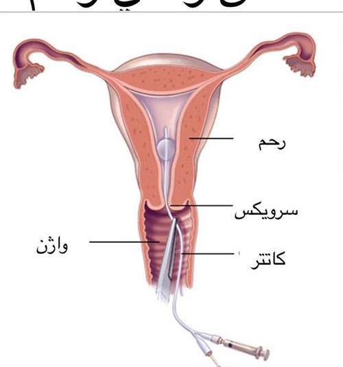 کیا عکس رنگی گرفتن و باردار شدن