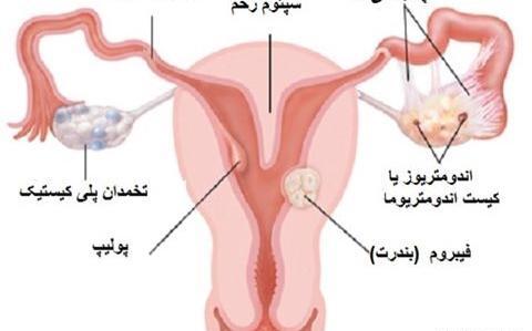 کیا عکس رنگی گرفتن