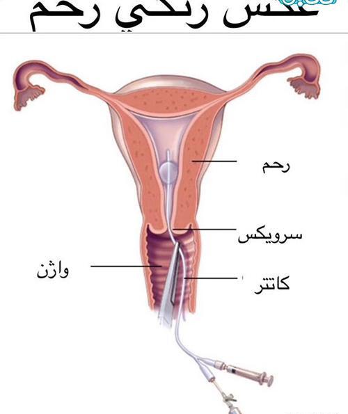 کیا عکس رنگی گرفتن نی نی سایت