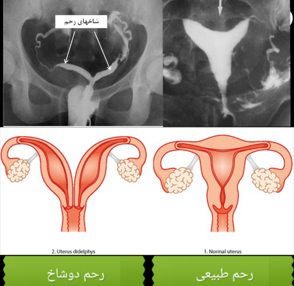 کیا عکس رنگی گرفتن نی نی سایت