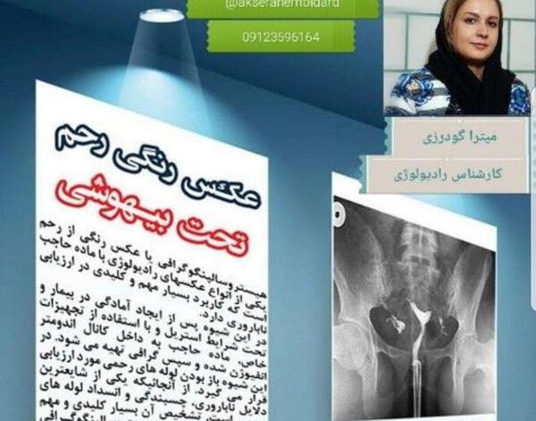 کیا عکس رنگی گرفتن نی نی سایت