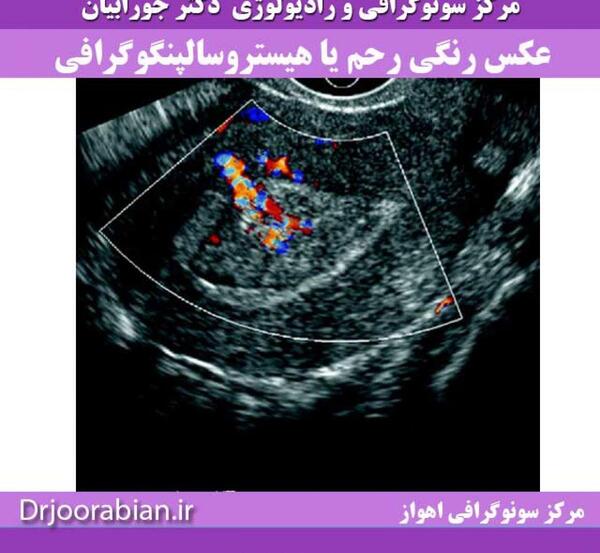 کیا عکس رنگی گرفتن نی نی سایت