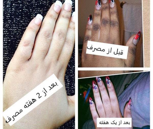عکس کرم لوتوس