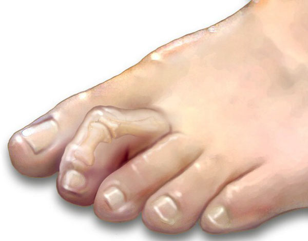 عکس اسکلت پا انسان
