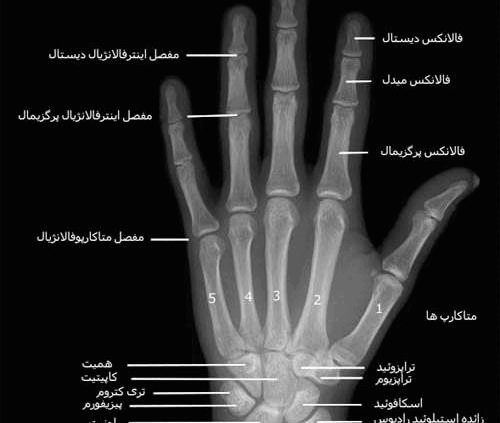 عکس اسکلت دست