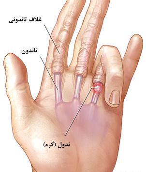 عکس اسکلت دست راست
