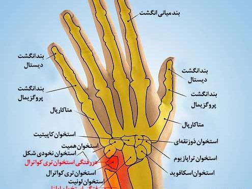 عکس اسکلت دست راست