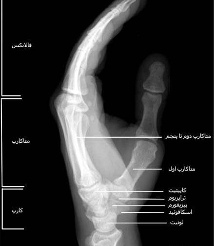 عکس اسکلت دست راست