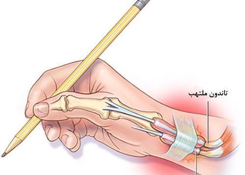 عکس اسکلت دست راست