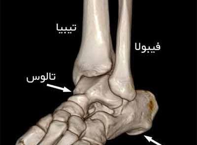 عکس اسکلت روی پا