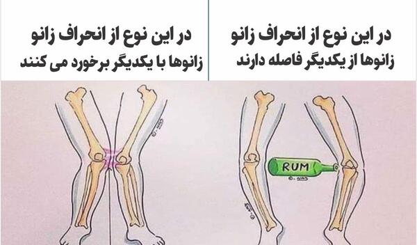 عکس اسکلت زانو