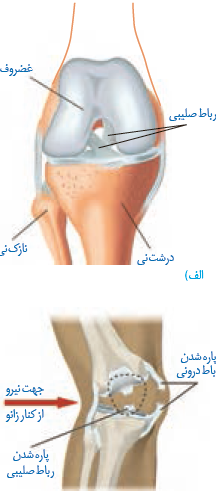 عکس اسکلت زانو