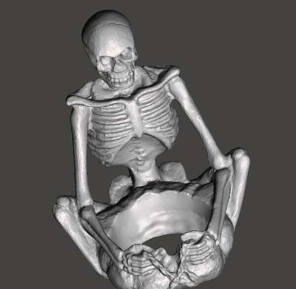 عکس اسکلت سه بعدی