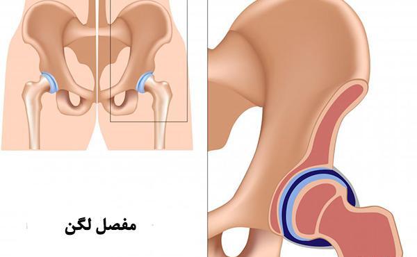 عکس اسکلت لگن