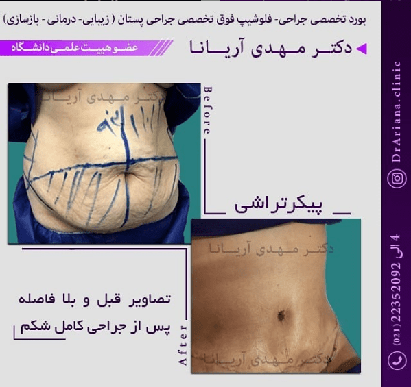 عکس مینی ابدو