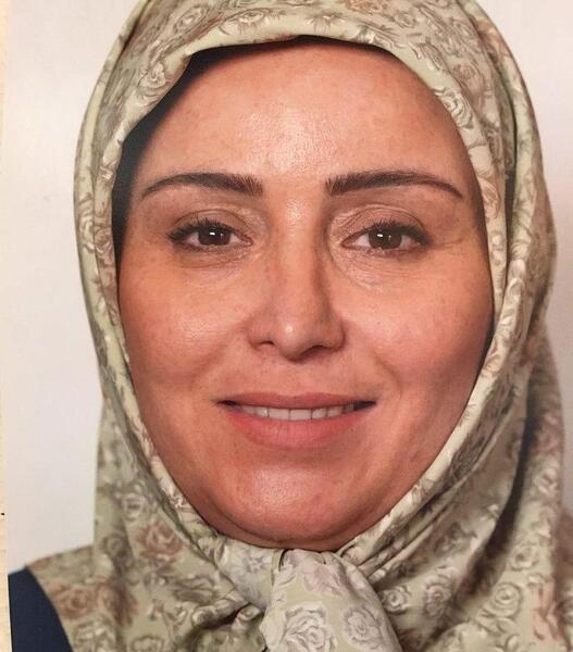 عکس قبل از عمل ژاله صامتی