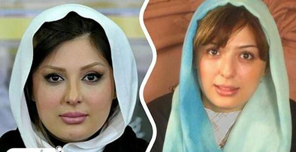 عکس نیوشا ضیغمی قبل از پروتز لب
