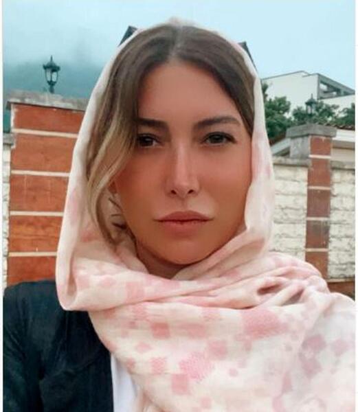 عکس نیوشا ضیغمی قبل از پروتز لب
