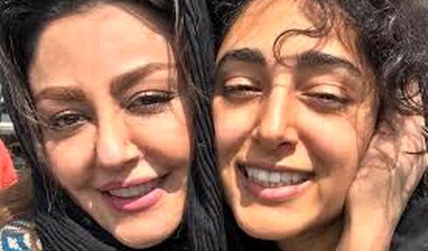 عکس شقایق فراهانی قبل عمل
