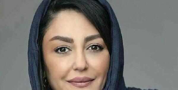 عکس شقایق فراهانی قبل عمل