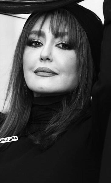 عکس شقایق فراهانی قبل عمل