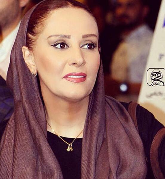 عکس شیوا خسرو مهر بعد از عمل زیبایی