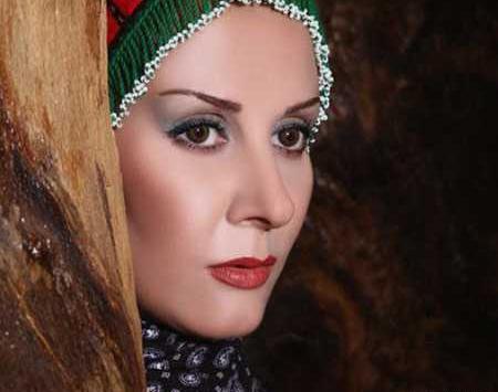 عکس شیوا خسرو مهر بعد از عمل زیبایی