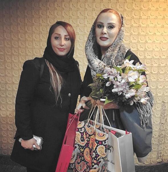 عکس شیوا خسرو مهر بعد از عمل زیبایی