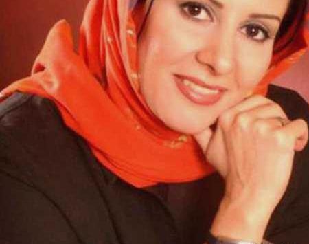 عکس شیوا خسرو مهر بعد از عمل زیبایی