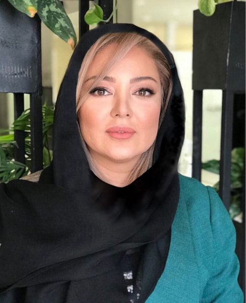عکس صبا کمالی قبل و بعد از عمل