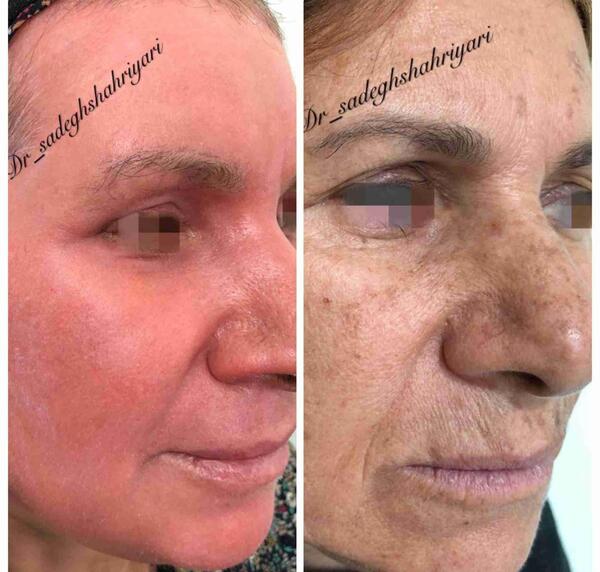 عکس صادق شهریاری