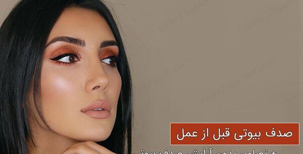 عکس صدف بیوتی قبل از عمل