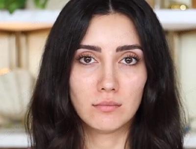 عکس صدف بیوتی قبل از عمل