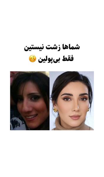 عکس صدف بیوتی قبل از عمل
