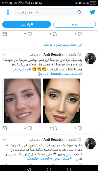 عکس صدف بیوتی قبل از عمل