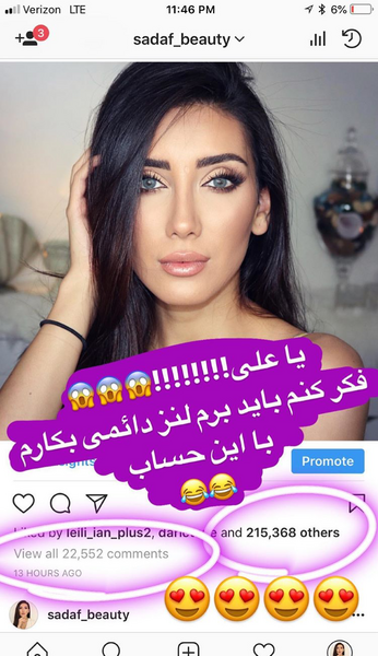 عکس صدف بیوتی قبل از عمل