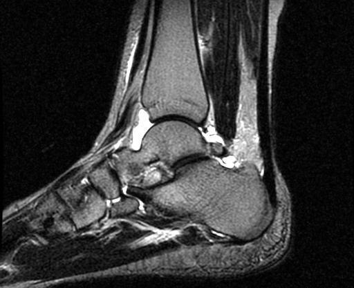 عکس های mri