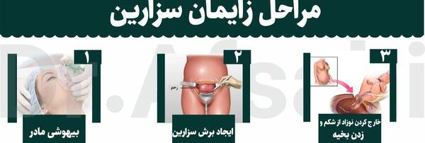 عکس فیلم زایمان طبیعی