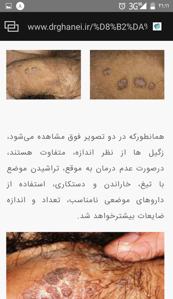 عکس سوتی اپیلاسیون نی نی سایت