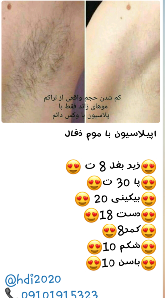 عکس سوتی اپیلاسیون نی نی سایت